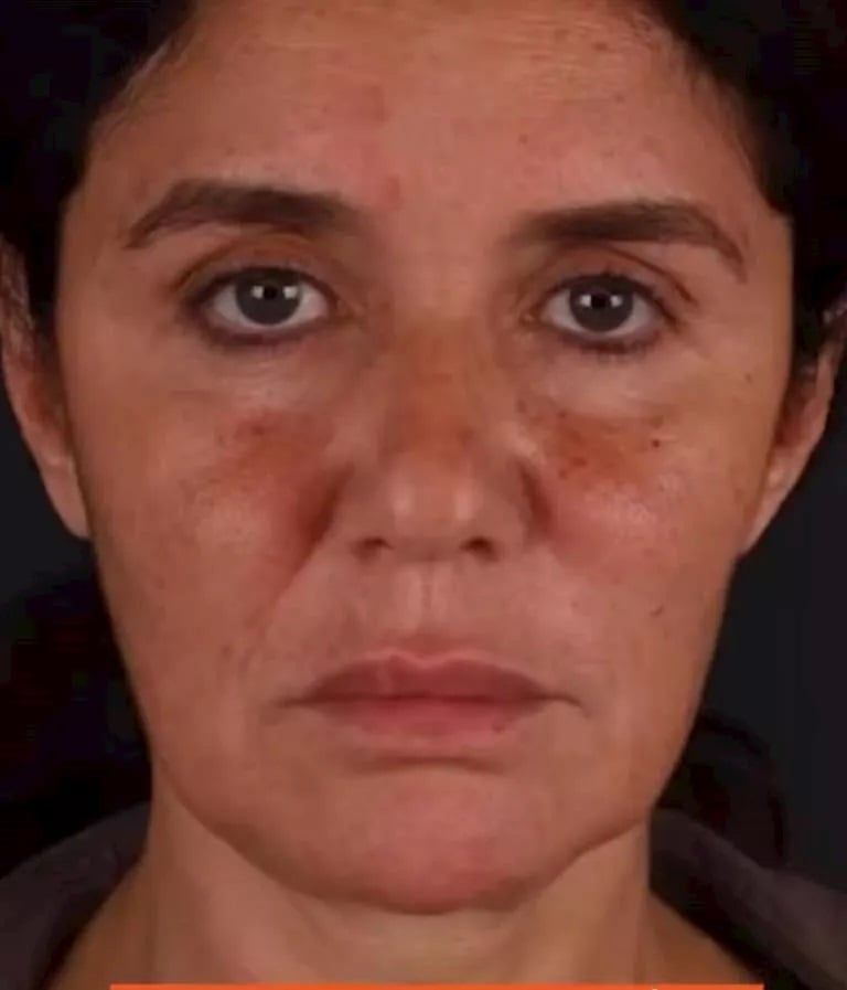 غادة عادل قبل العملية غادة عادل قبل العملية