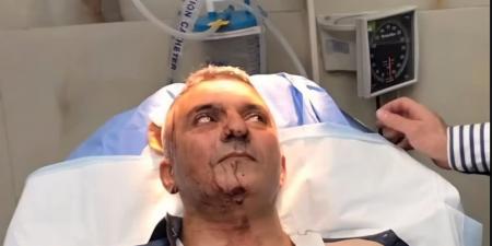 الاعتداء على الصحفي فارس الحباشنة أمام منزله.. والجهات الأمنية تحقق - بوابة فكرة وي