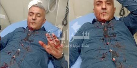 "الصحفيين" تدين الاعتداء على الزميل فارس حباشنة - بوابة فكرة وي